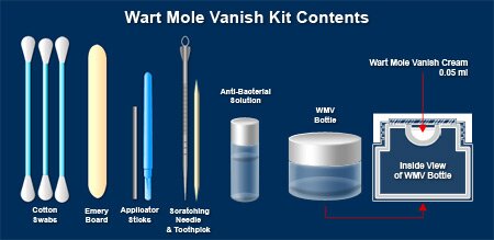 wart mole vanish remover